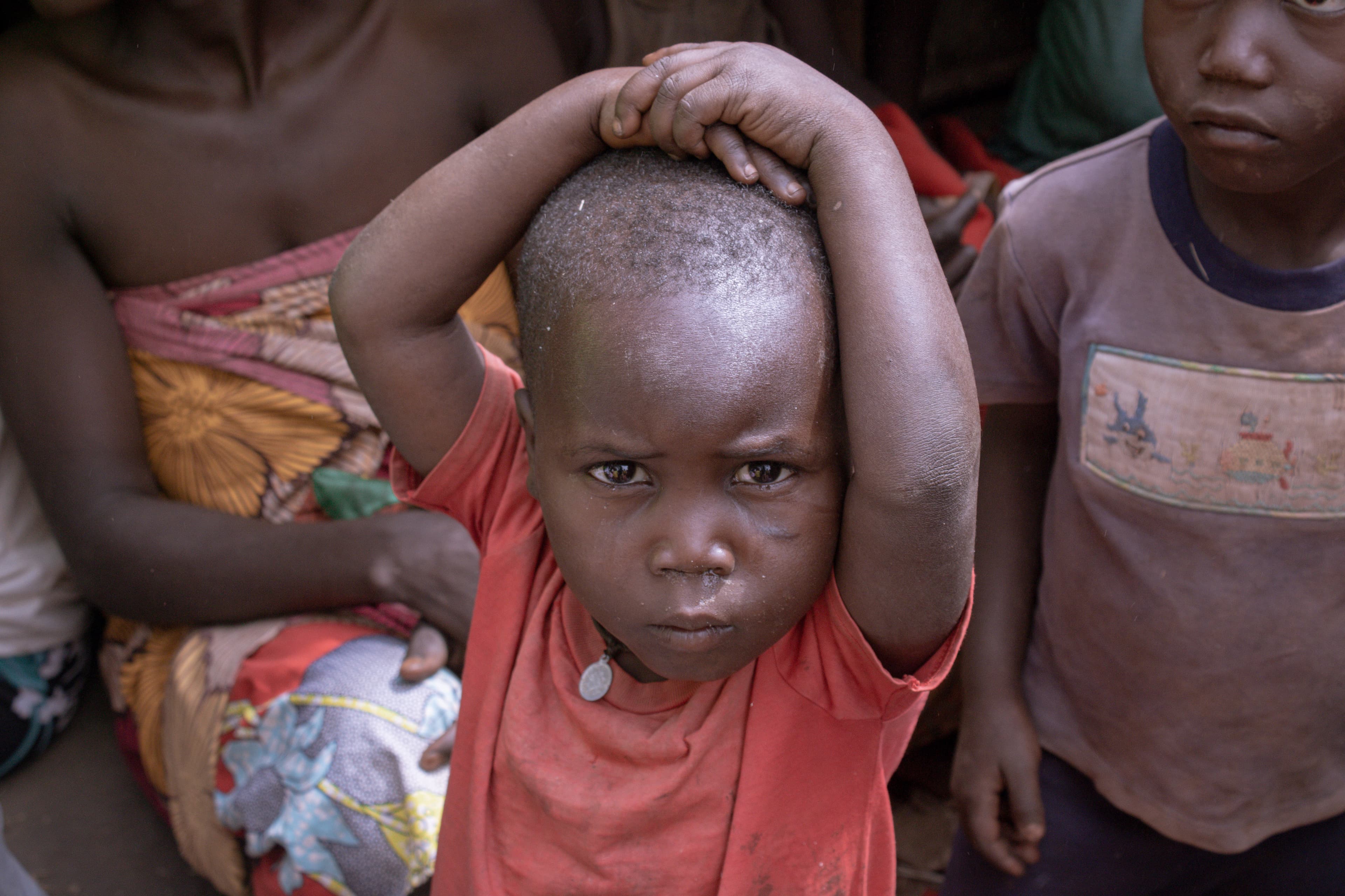 Close-up of a young child with a visible wound on the forehead, held by an adult.
