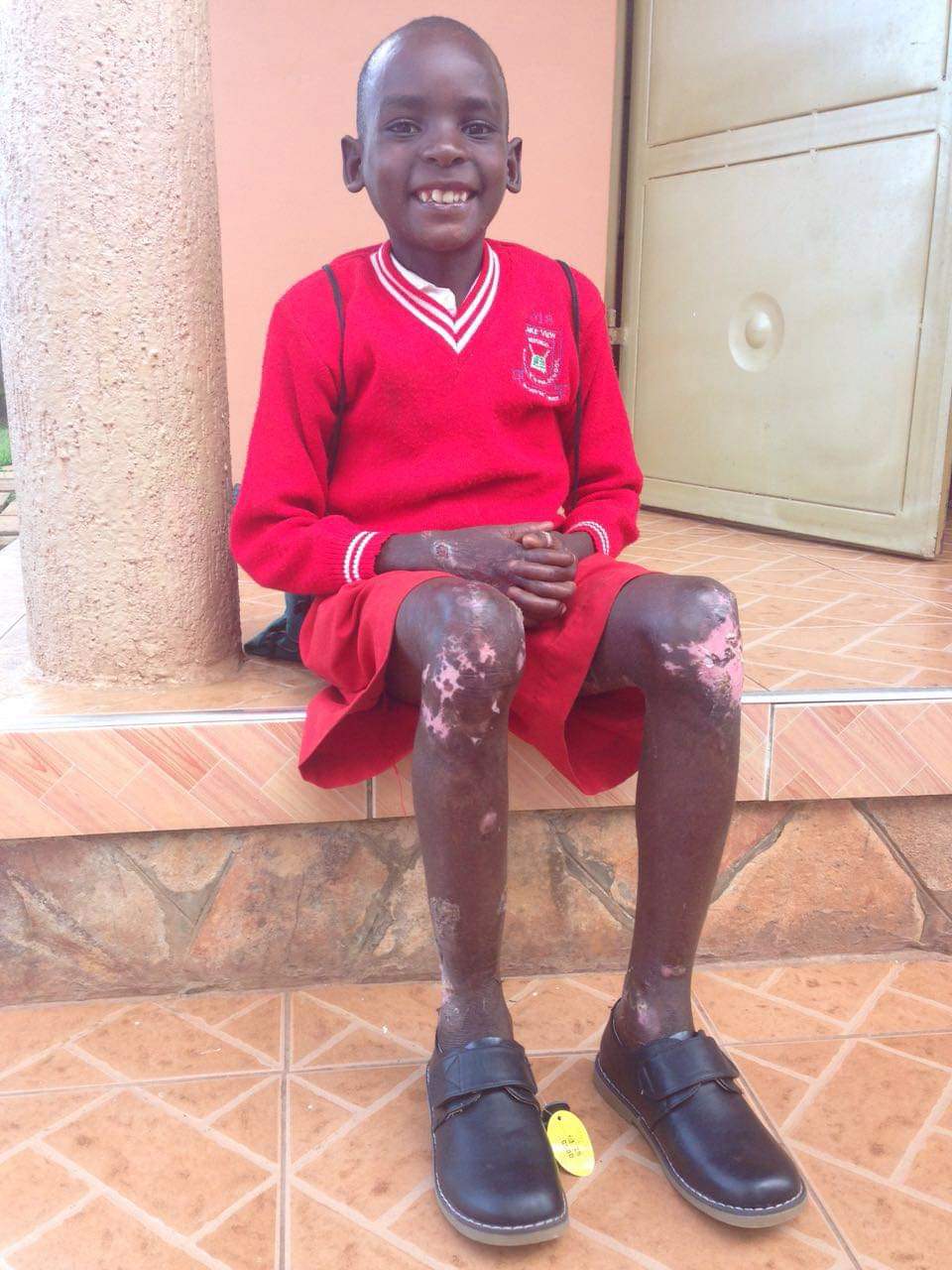 Eric, a teenage boy in a red school uniform, sits on outdoor steps with skin lesions visible on his knees.