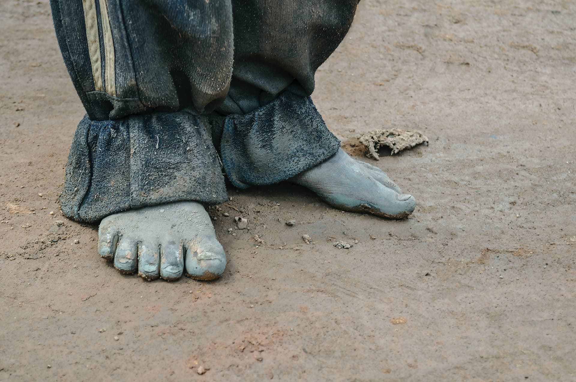 Close-up of a person's bare, dusty feet standing on dirt ground, worn trousers visible above