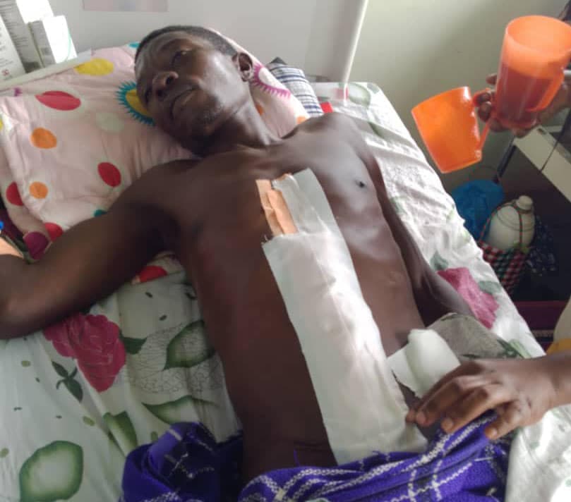Paul lies in a hospital bed with an IV line, recovering after intestinal obstruction surgery at Miracle Medical Center.