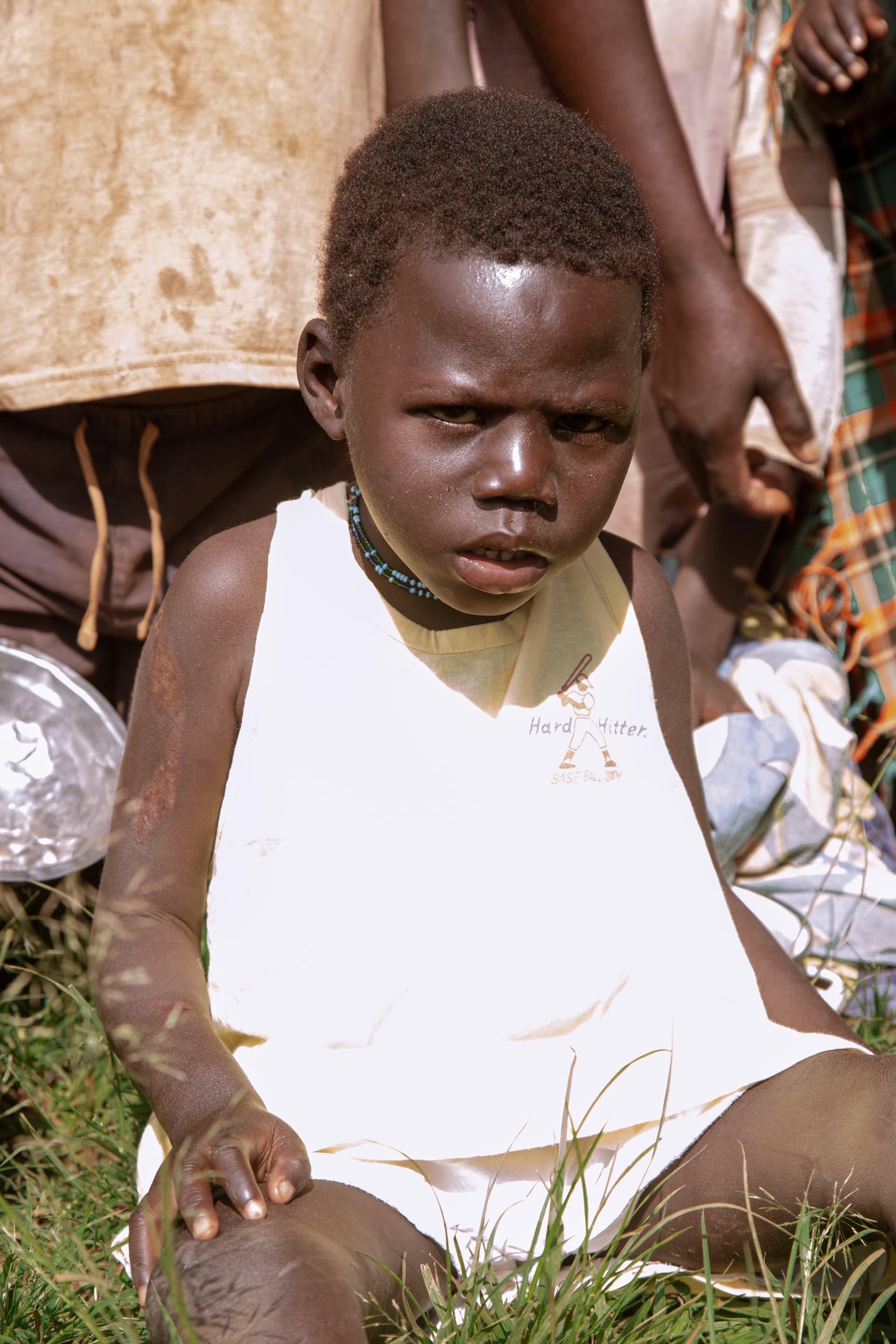 Young boy in a white outfit sitting on the grass outdoors, identified in the post as Aloyi, who was born unable to walk.