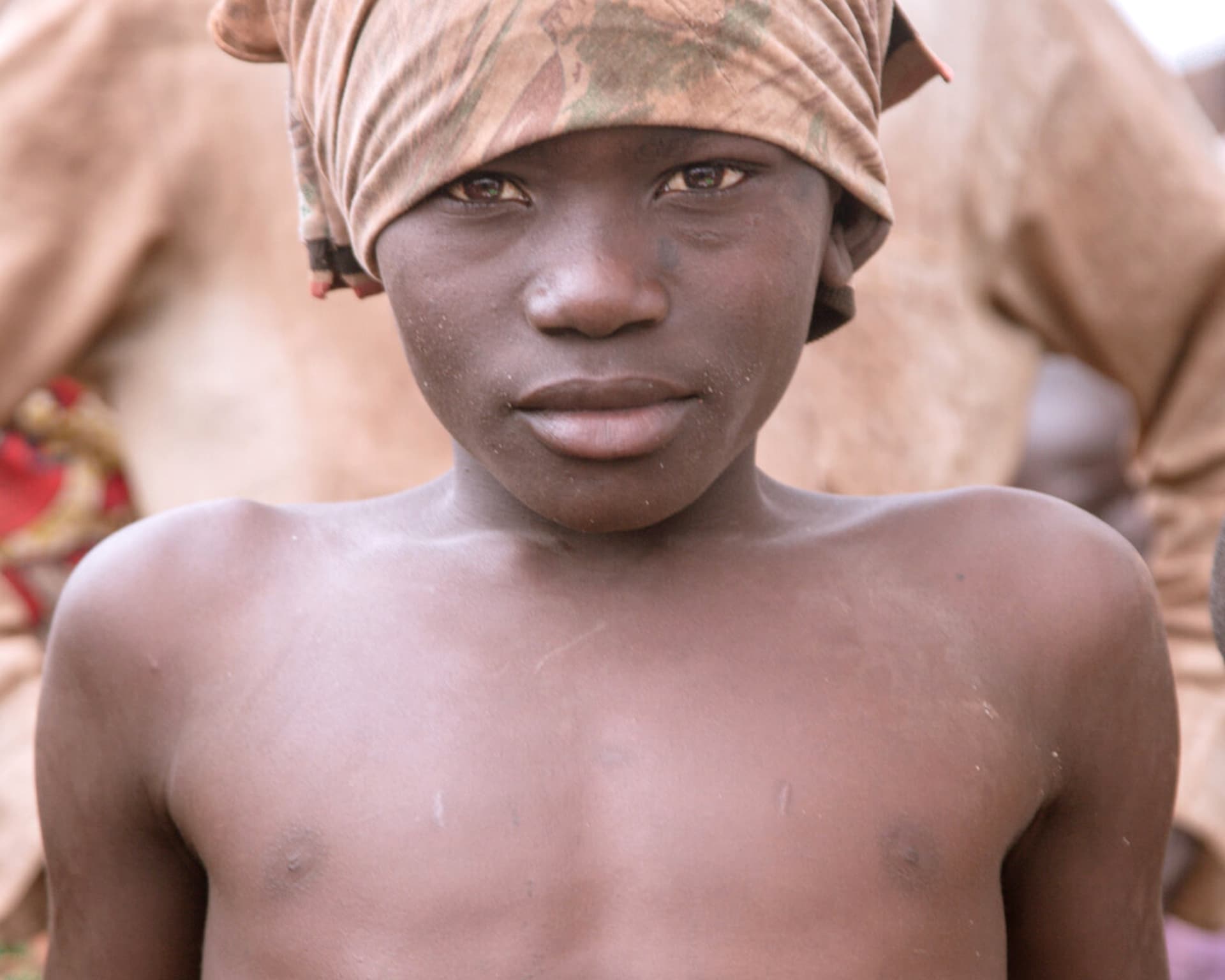 Close-up portrait of a boy wearing a headwrap, his thin torso visible, during a food outreach.