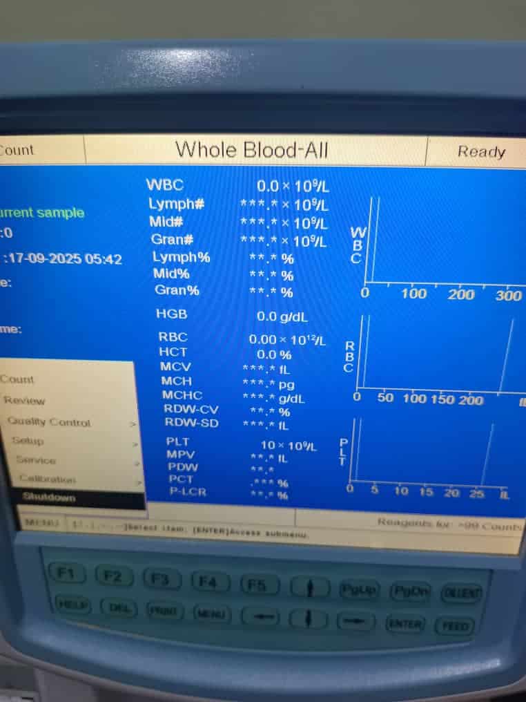 Screenshot of a hematology analyzer's "Whole Blood-All" results screen used at Miracle Medical Center.